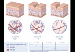 都在問的乙酰殼糖胺（NAG）功效怎么樣？功效成分的護(hù)膚品應(yīng)該怎么選？