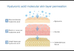 如何選擇適合油痘肌的精華產(chǎn)品？